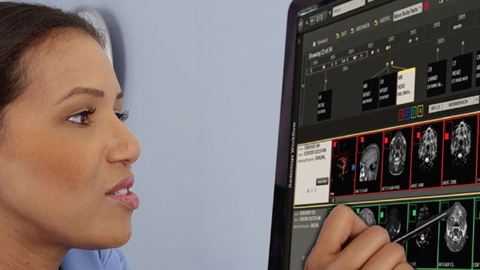 intellispace radiology workspace solution