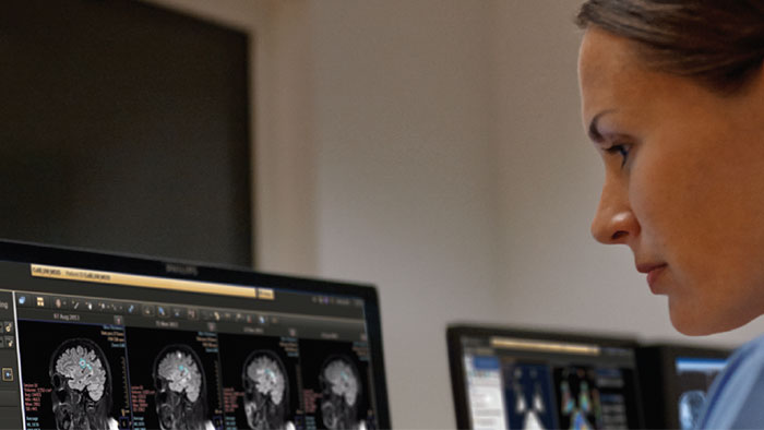 intellispace universal data manager