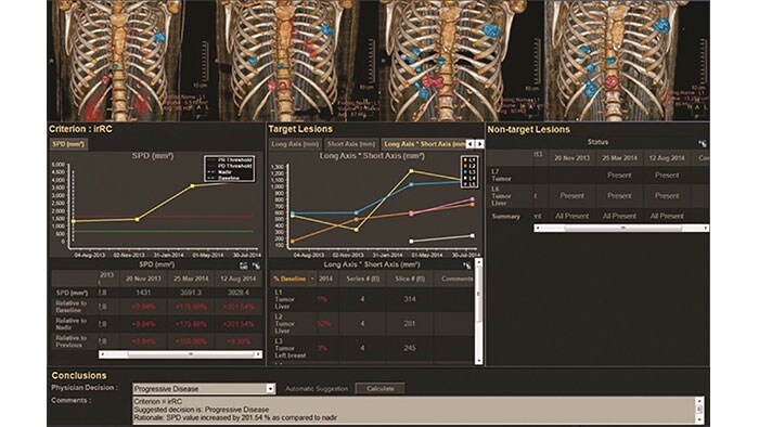 tumor tracking thumbnail