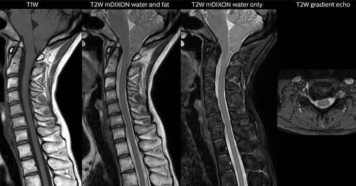 magnetic resonance for the ED