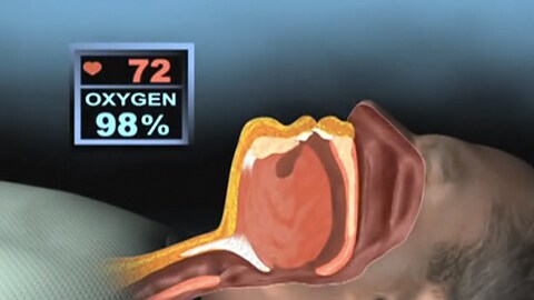 Examining sleep apnea