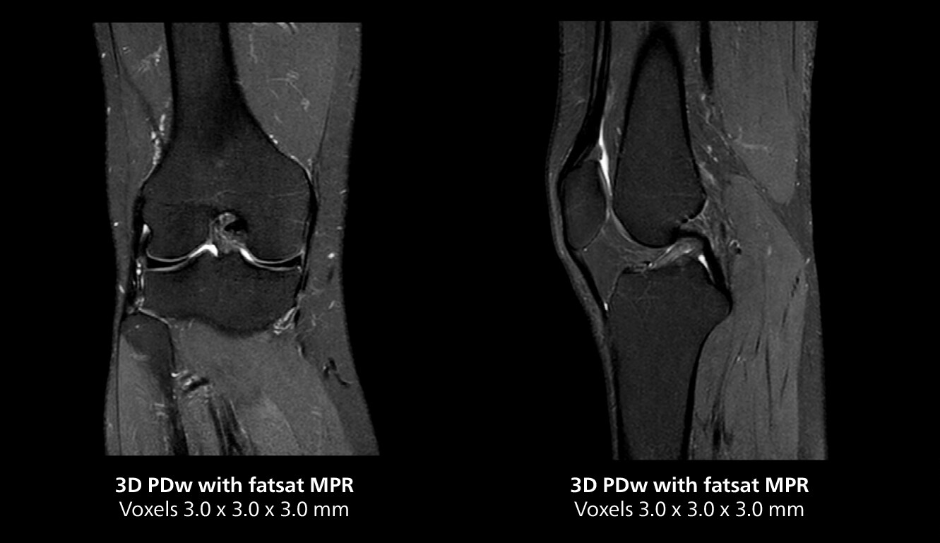 Knee mri two