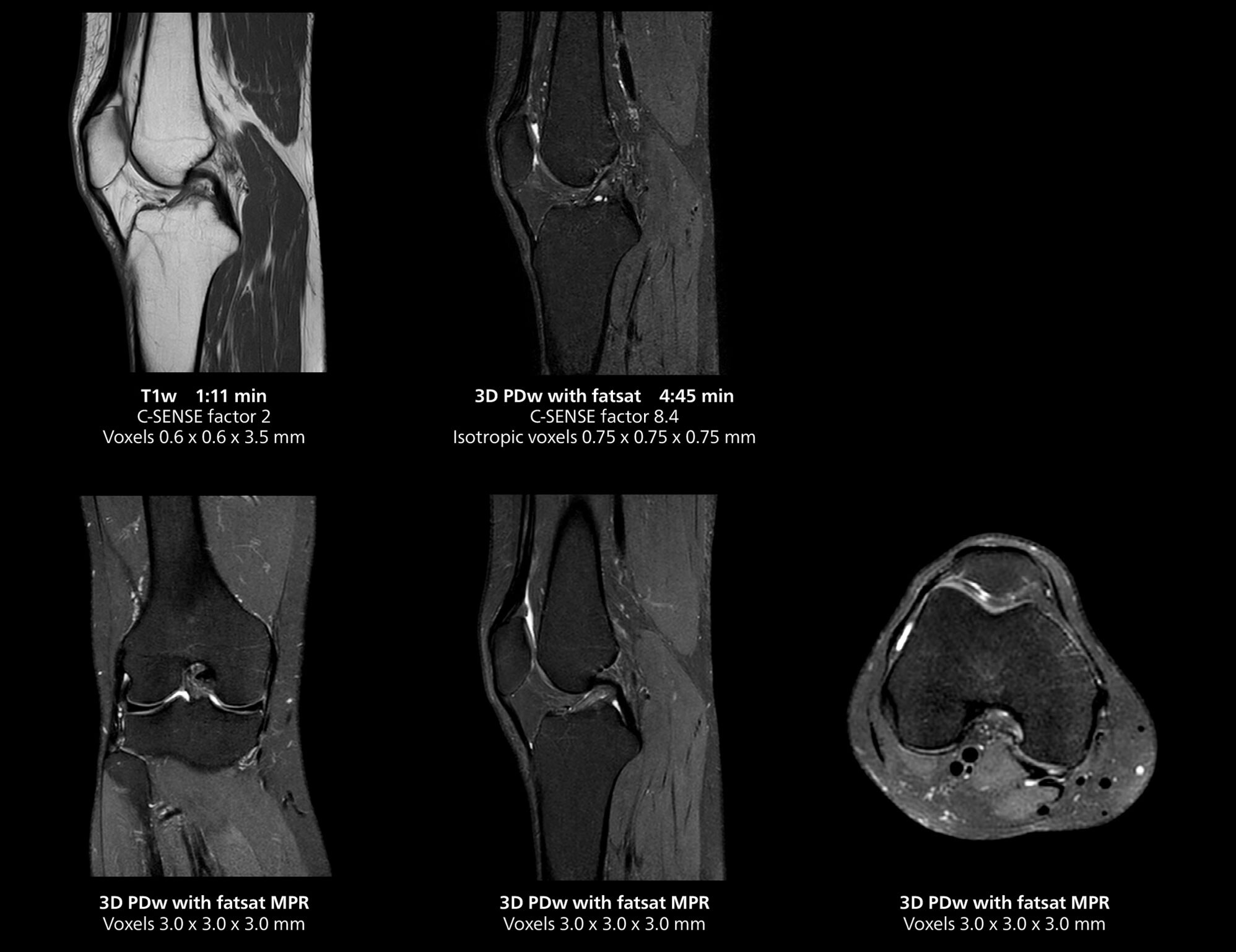 Knee mri 