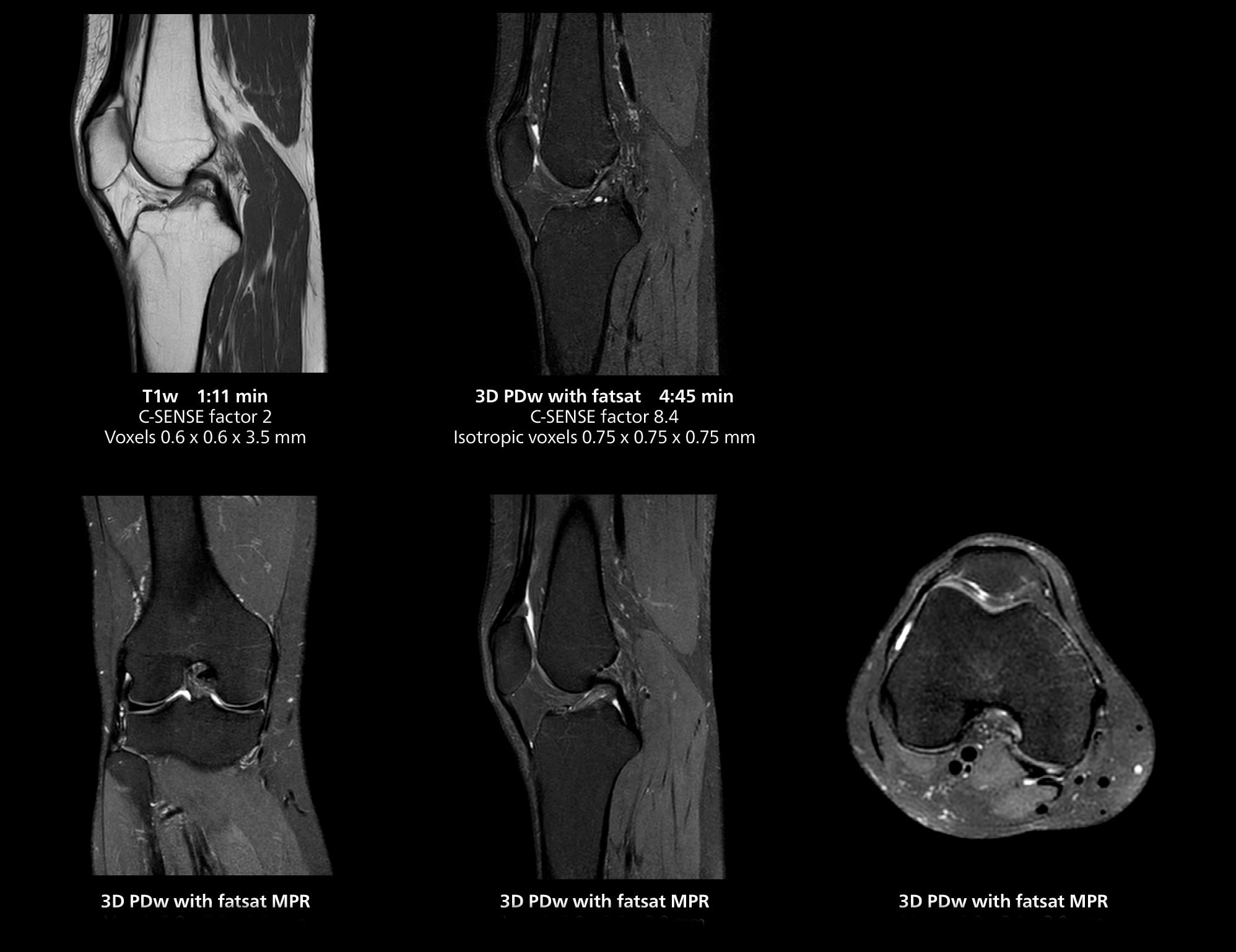 Knee mri 