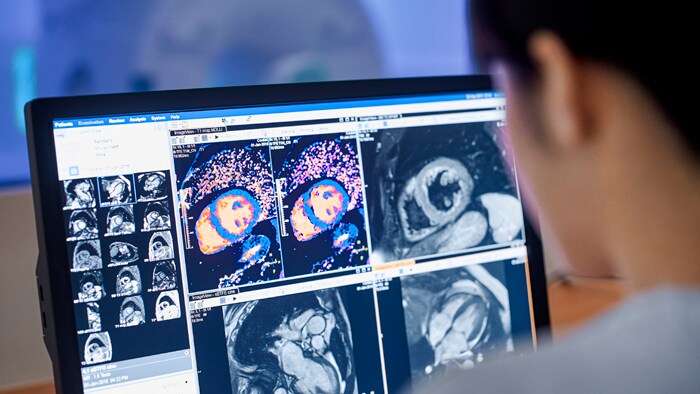 cardiac MRI service