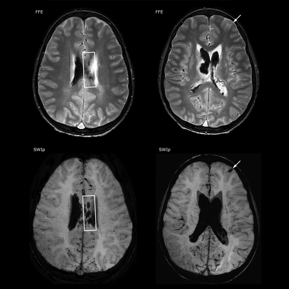 SWIp clinicalcase