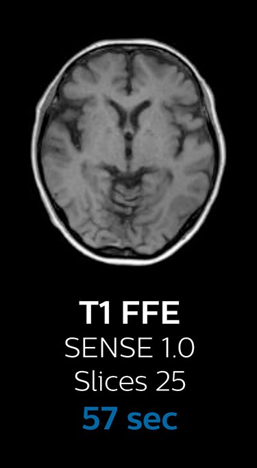 T1 FFE magnetic resonance