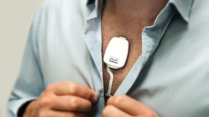 Atrial fibrillation screening: a way toward stroke prevention