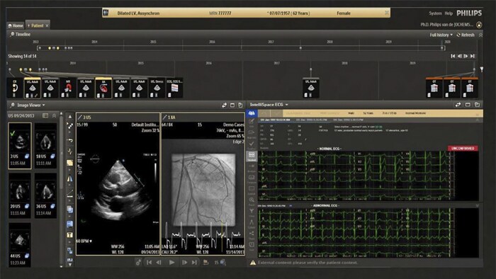 Cardiovascular diagnostic information