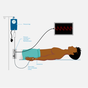 Non-invasive blood pressure measurement | Philips
