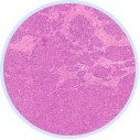 Histopathology