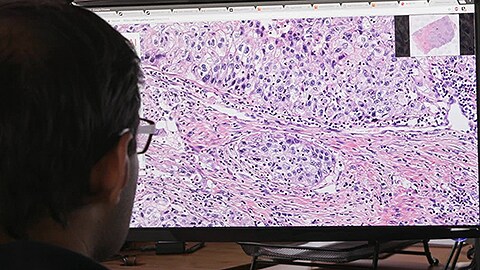 Philips and PathAI team up to improve breast cancer diagnosis using artificial intelligence technology in ‘big data’ pathology research