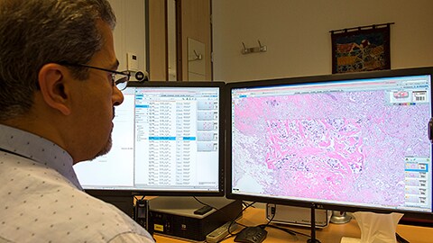 Philips introduces new digital solutions and services to advance pathology at the 2017 USCAP Annual Meeting