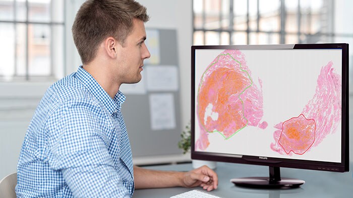 Philips introduces computational pathology software for automated prostate and ovarian tumor detection at ECP 2018