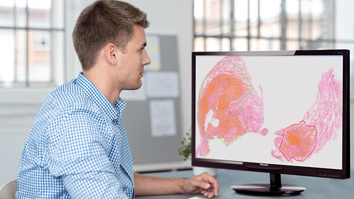 Philips showcases digital pathology system for clinical use and advanced imaging analytics to transform pathology services at USCAP 2018