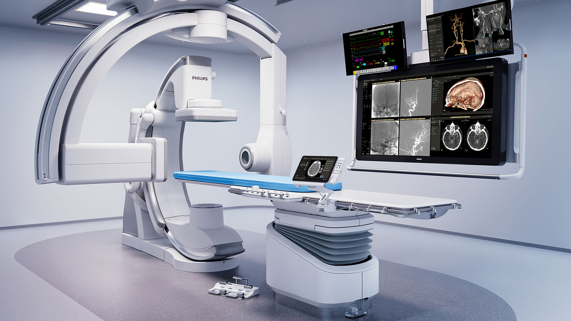 Philips launches new Azurion neuro biplane system at #ECR2024 to speed up and improve minimally invasive diagnosis and treatment of neurovascular patients