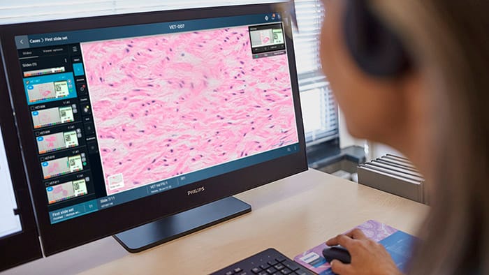 Philips expands digital pathology portfolio with cloud-enabled Philips IntelliSite Pathology Solution on HealthSuite